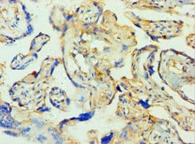 TTBK2 Antibody (aa1185-1244)