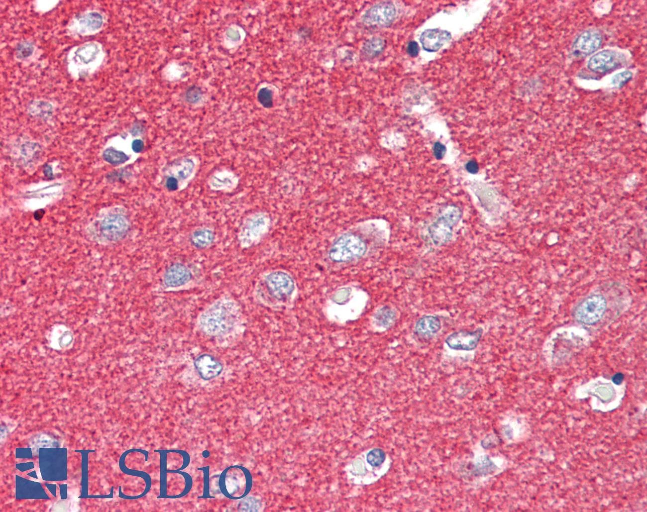 IHC-plus™ SNAP25 Antibody (aa193-206)
