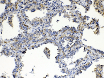 TIMP4 Antibody
