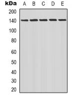 LATS1 + LATS2 Antibody (C-Terminus)