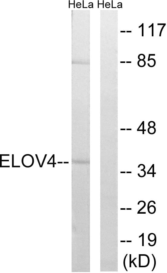 ELOVL4 Antibody (aa41-90)