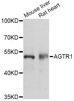 AGTR1 / AT1 Receptor Antibody