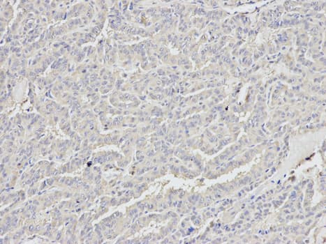 DDX5 Antibody