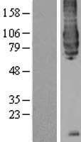 BACE1 / BACE Protein (Over-Expression Lysate Myc-DDK (Flag))