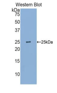 GSTP1 / GST Pi Antibody (aa1-210, APC)