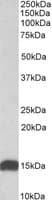 IHC-plus™ NDUFS6 Antibody (aa53-66)