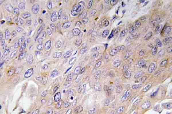 BMP3 Antibody (Glu306)