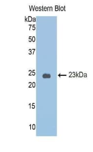 SERPINA6 / CBG Antibody (aa25-195)