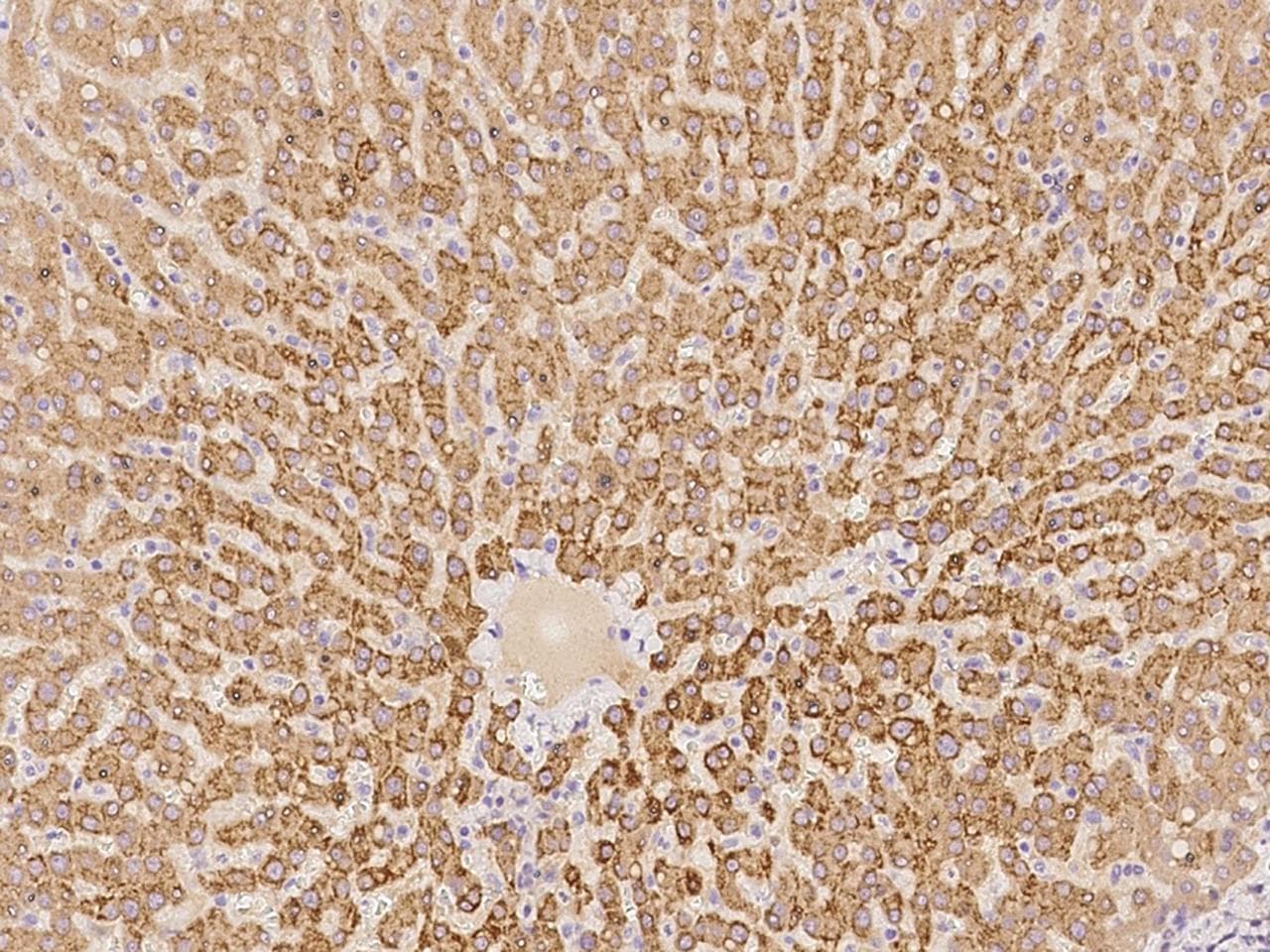 ACS5 / ACSL5 Antibody
