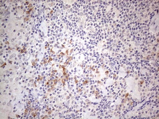 MARK4 Antibody (aa390-467, clone OTI9B7, Carrier-free)