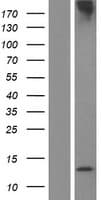 TP53AIP1 / p53 AIP1 Protein (Over-Expression Lysate Myc-DDK (Flag))
