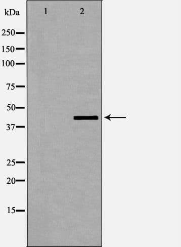 DMTN / Dematin Antibody (phospho-Ser403)