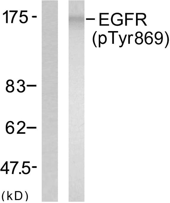 EGFR Antibody (phospho-Tyr869)