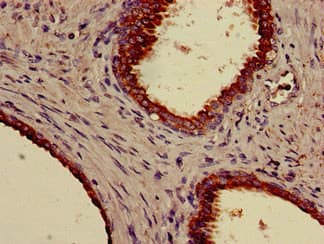 KRT18 / CK18 / Cytokeratin 18 Antibody (Biotin)