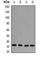 CAPZB / CAPZ Beta Antibody