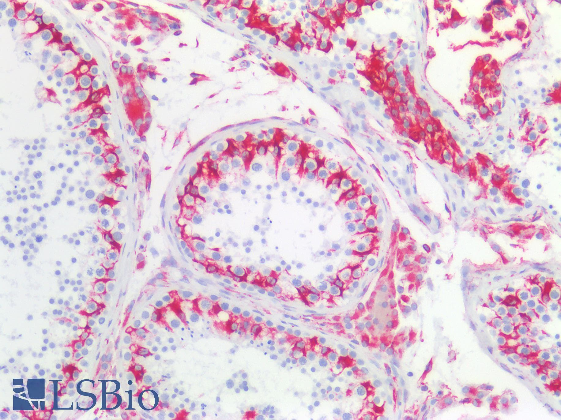 PathPlus™ Vimentin Antibody (clone AT5H8)