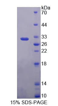 Human CELSR3 Protein (Recombinant His-T7)