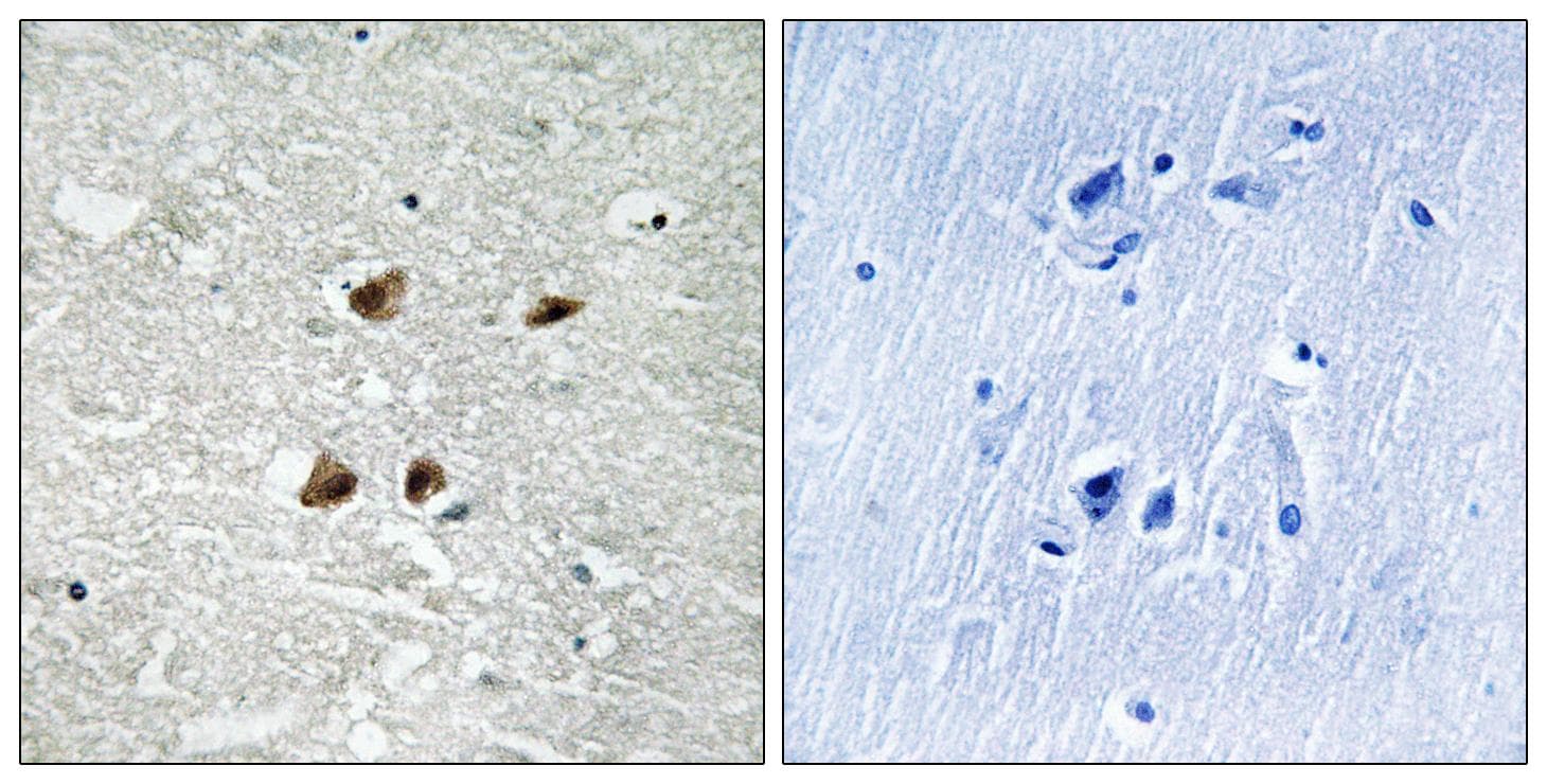 HSF1 Antibody (phospho-Ser121)