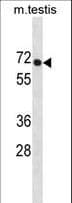 PLD3 / Phospholipase D3 Antibody (aa9-37)