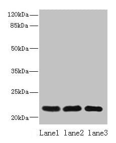 Polyclonal Rabbit anti-Human SSR3 / TRAP-Gamma Antibody (IHC, WB)