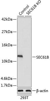 Polyclonal Rabbit anti-Human SEC61B Antibody (IF, WB)