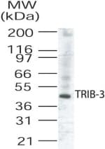 Polyclonal Rabbit anti-Human TRB3 / TRIB3 Antibody (aa315-332, WB)