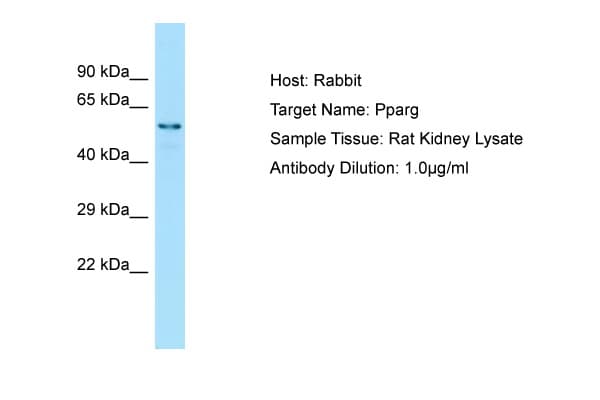 Polyclonal Rabbit anti-Rat PPARG / PPAR Gamma Antibody (C-Terminus, WB)