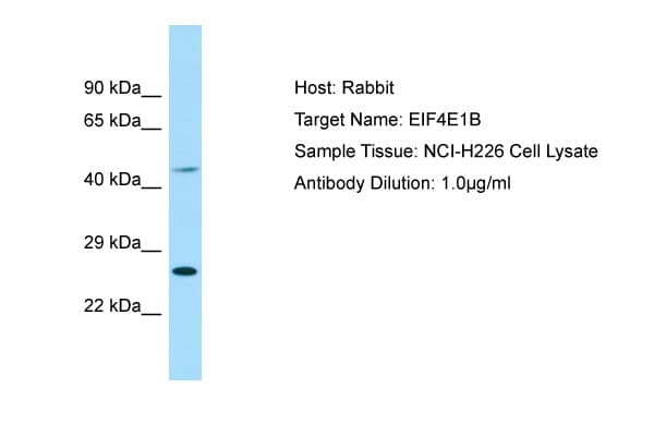 EIF4E1B Antibody (aa114-163)