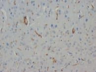 NEFH / NF-H Antibody (C-Terminus, clone NF-200)