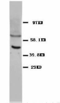 TP53 / p53 Antibody (clone IMD-53, Magnetic beads)