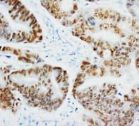 Monoclonal Mouse anti-Human TP53 / p53 Antibody (clone IMD-53, IHC, WB)