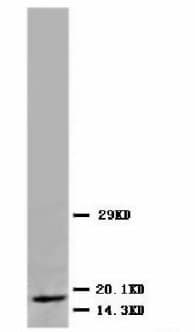 MB / Myoglobin Antibody (clone 41286)