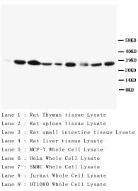Monoclonal Mouse anti-Human BCL2 / Bcl-2 Antibody (clone BL-2, aa41-54, IHC, WB)