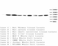 BCL2 / Bcl-2 Antibody (aa41-54, clone BL-2, Magnetic beads)