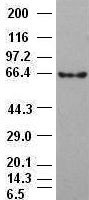 Monoclonal Mouse anti-Human CTNNB1 / Beta Catenin Antibody (clone OTI2H3, WB)