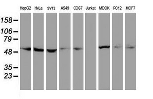 Monoclonal Mouse anti-Human TUBAL3 Antibody (clone OTI4D9, IHC, WB)