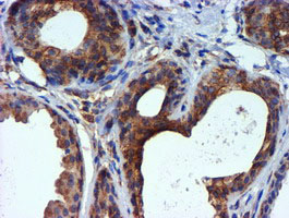 Monoclonal Mouse anti-Human TUBAL3 Antibody (clone OTI4D9, IHC, WB)