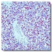 Monoclonal Mouse anti-Human MYOG / Myogenin Antibody (IHC, IF, WB)