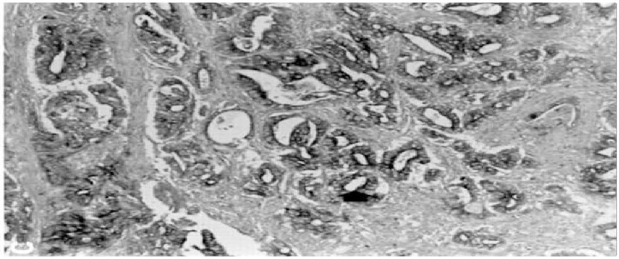 Monoclonal Mouse anti-Human MMP3 Antibody (IHC, WB)