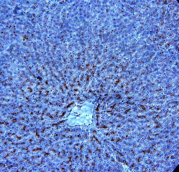 Polyclonal Goat anti-Human ADIPOR1/Adiponectin Receptor 1 Antibody (aa2-26, IHC, WB)