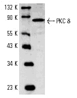 PRKCD / PKC-Delta Antibody (Gly499)