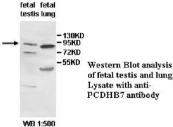 PCDHB7 Antibody (aa188-456)