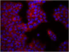 ITGB1 / Integrin Beta 1 / CD29 Antibody (clone TS2/16)