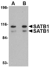 SATB1 Antibody