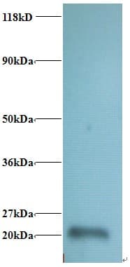IHC-plus™ Polyclonal Rabbit anti-Human RPL36AL Antibody (IHC, WB)
