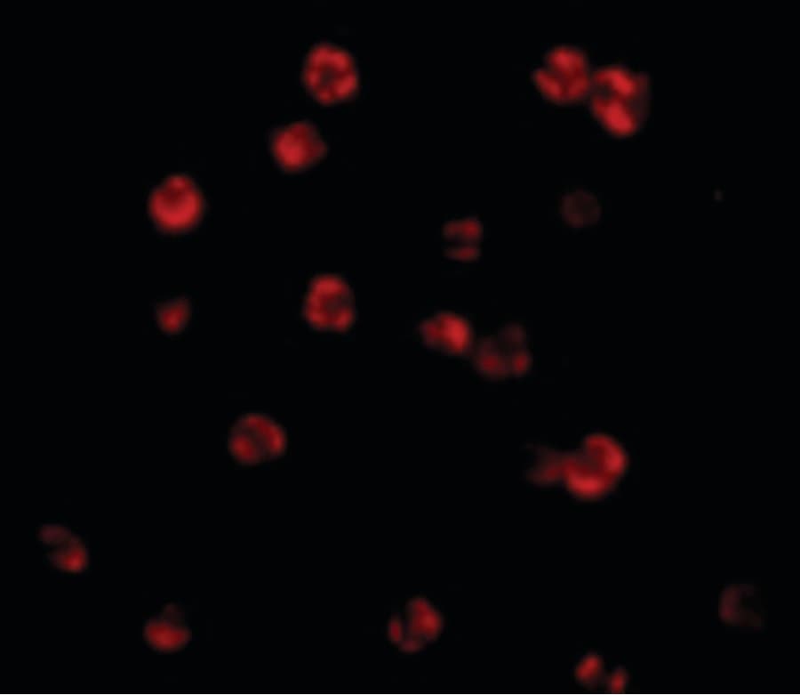 Polyclonal Rabbit anti-Human CFLAR / FLIP Antibody (IHC, IF, WB)