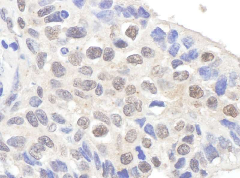 Polyclonal Rabbit anti-Human CLSPN / Claspin Antibody (aa725-775, IHC, WB)
