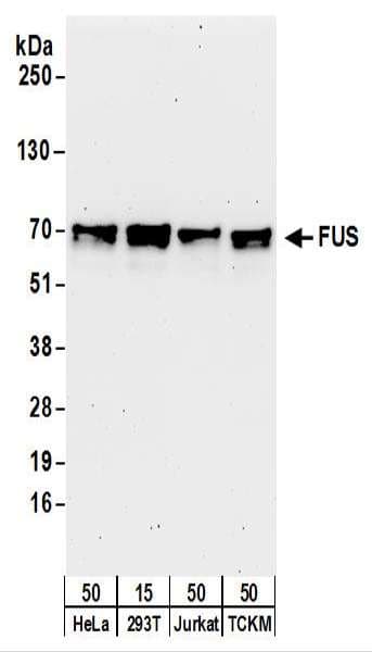 Polyclonal Rabbit anti-Human FUS / TLS Antibody (aa1-50, IHC, WB)