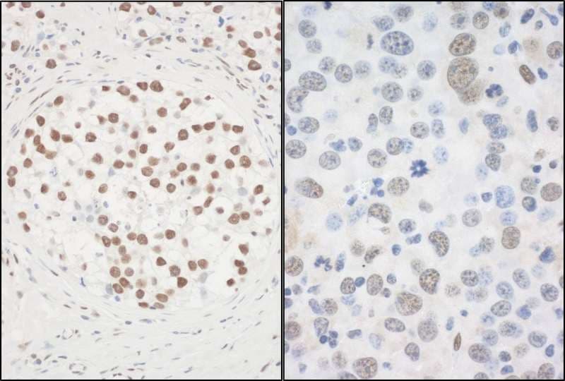 Polyclonal Rabbit anti-Human FUS / TLS Antibody (aa1-50, IHC, WB)