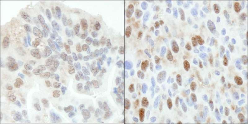 Polyclonal Rabbit anti-Human TP53BP2 / ASPP2 Antibody (aa825-875, IHC, WB)